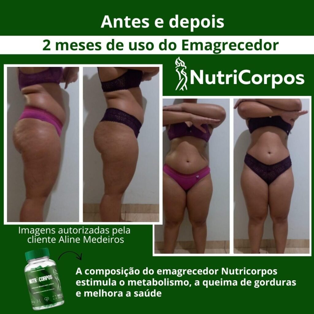 Antes e depois do emagrecedor